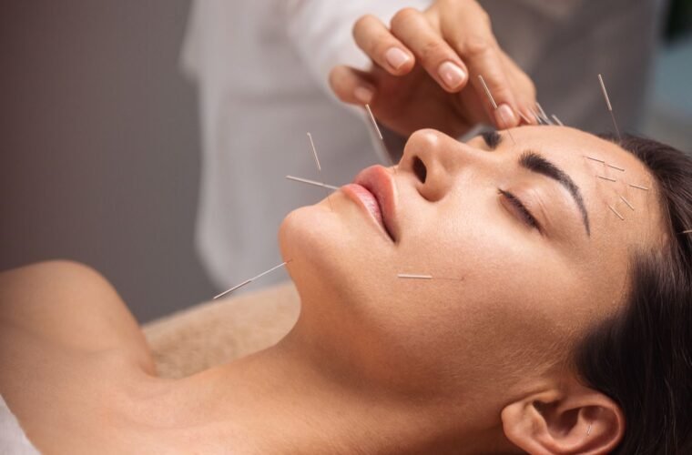 acupuncture benefits science